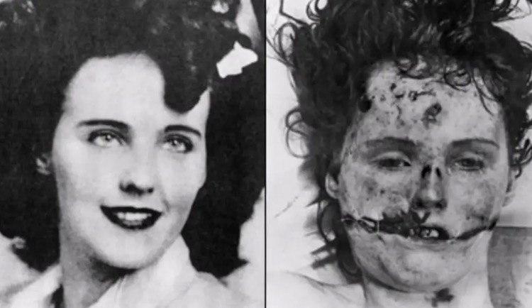 😱 🔴Graphic Content Warning🔴 😱+ The Black Dahlia: The brutal murder of Elizabeth Short